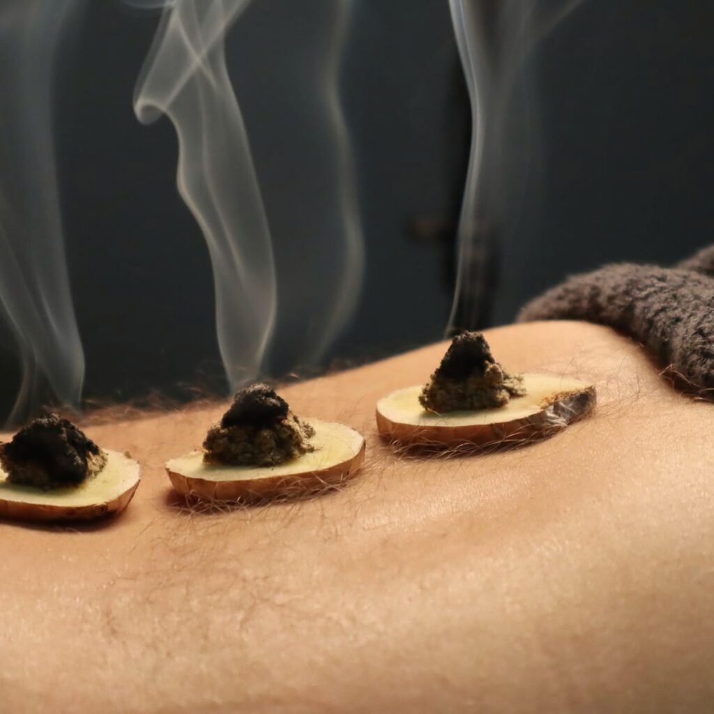 TCM Moxibustion treatment package