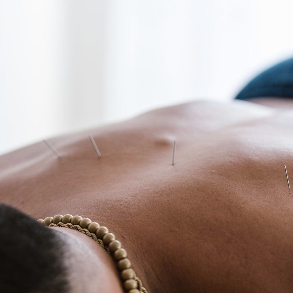 Tuina & acupuncture